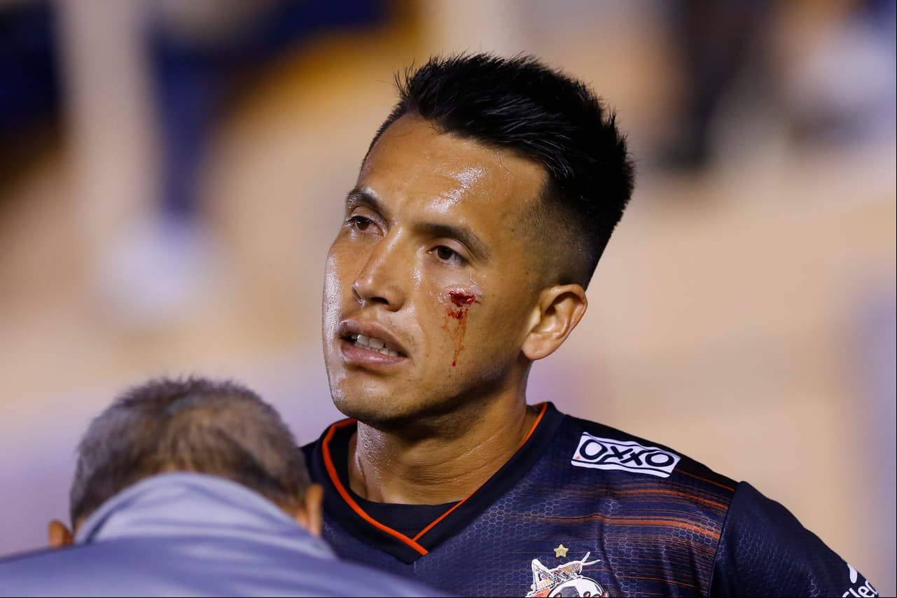 El juego no tardó demasiado en ponerse físico. En la imagen Luis Padilla de los Alebrijes mostrando las huellas de la batalla. Un corte, estilo boxeador, debajo del ojo izquierdo.