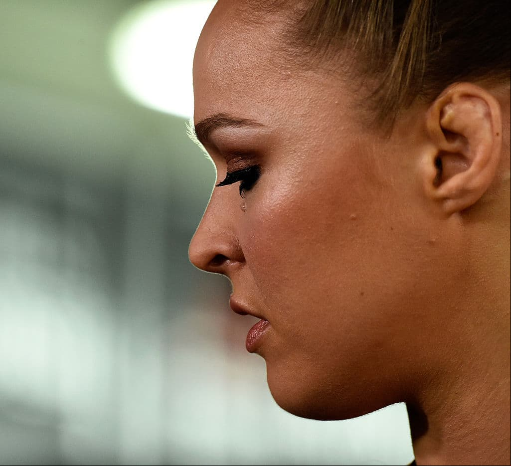 Ronda Rousey, recordada campeona de UFC, hoy en la lucha libre de WWE tampoco se salvó y tiene su oreja de coliflor.